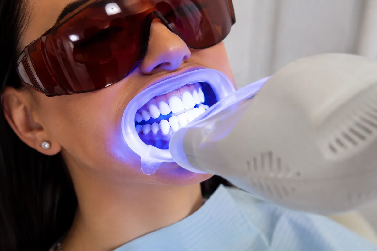 Teeth Whitening