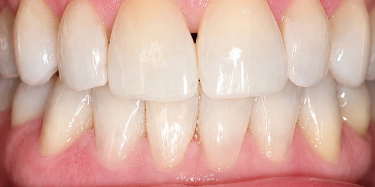 Case 7 — Before